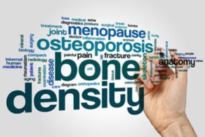 bone density (1)